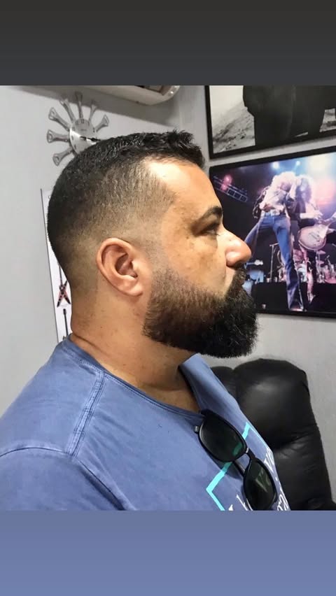 Barba Terapia